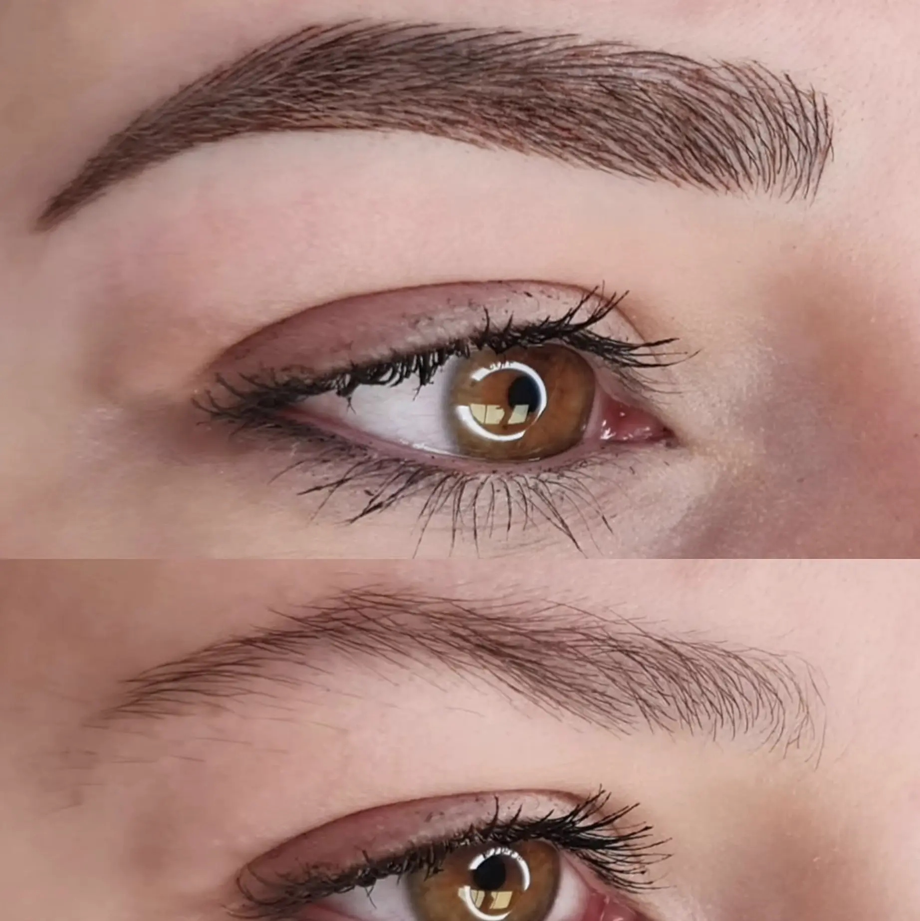 Why Should You Avoid Botox Before Microblading?