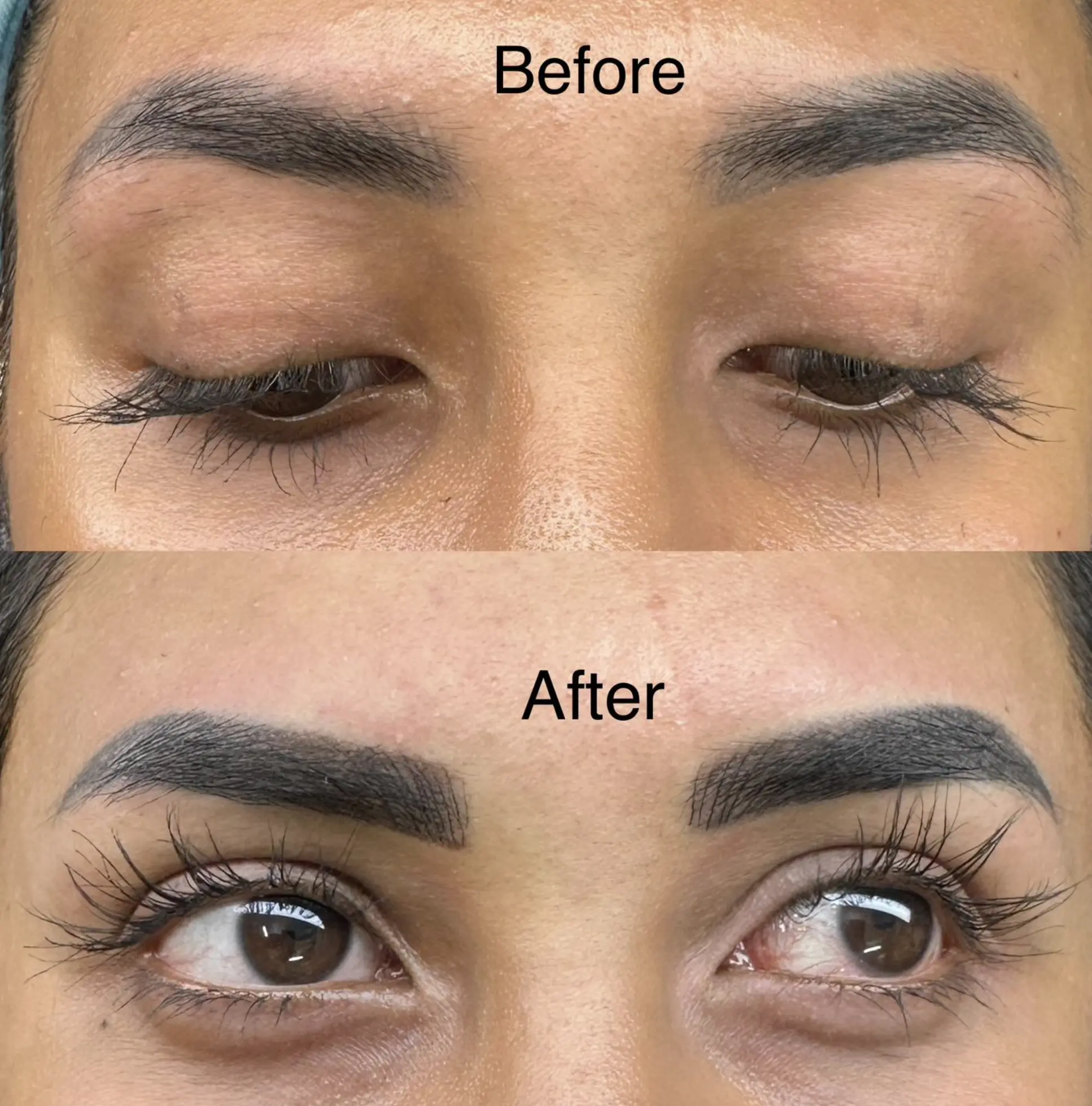 botox before microblading