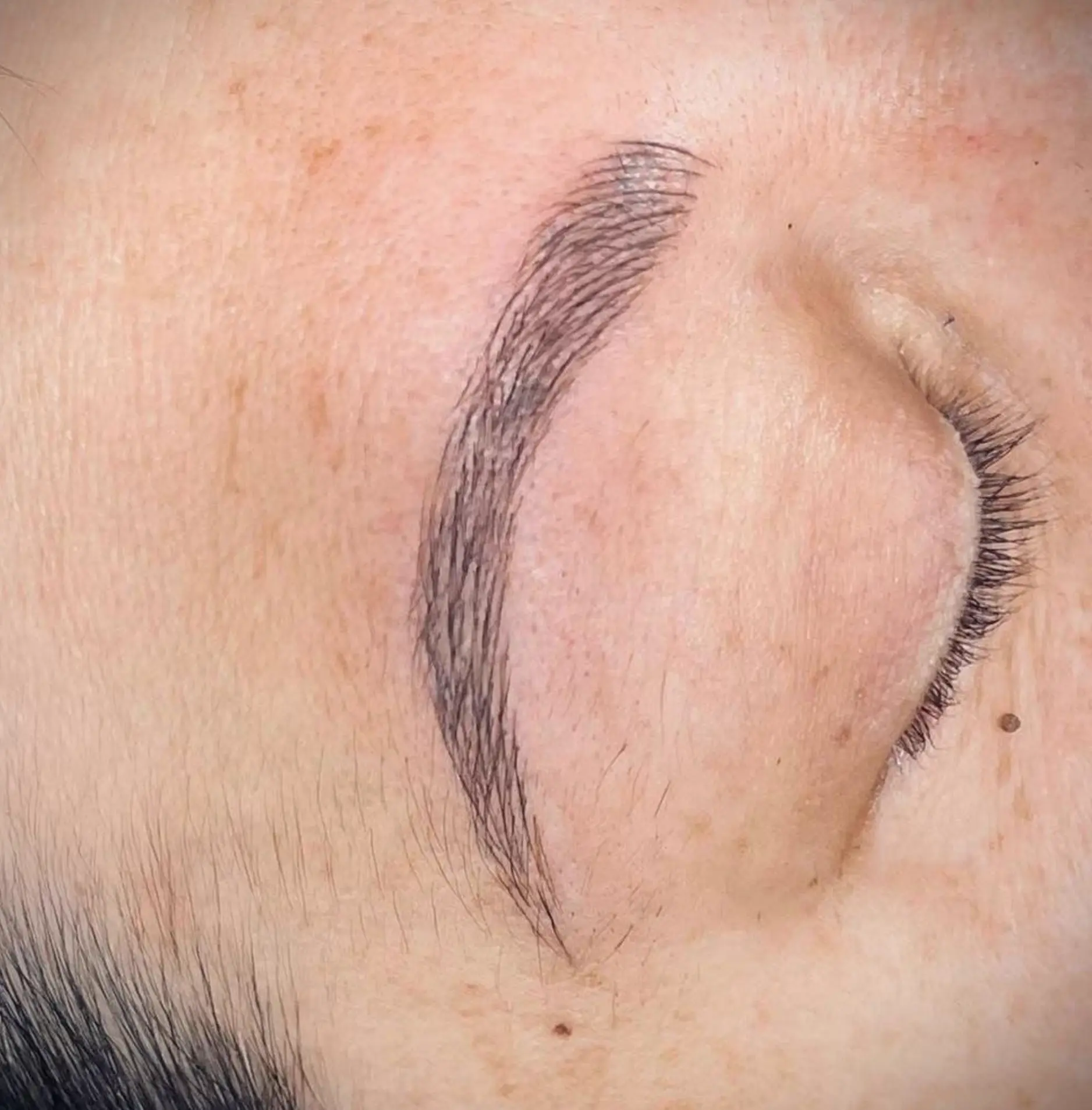 can you get microblading after botox