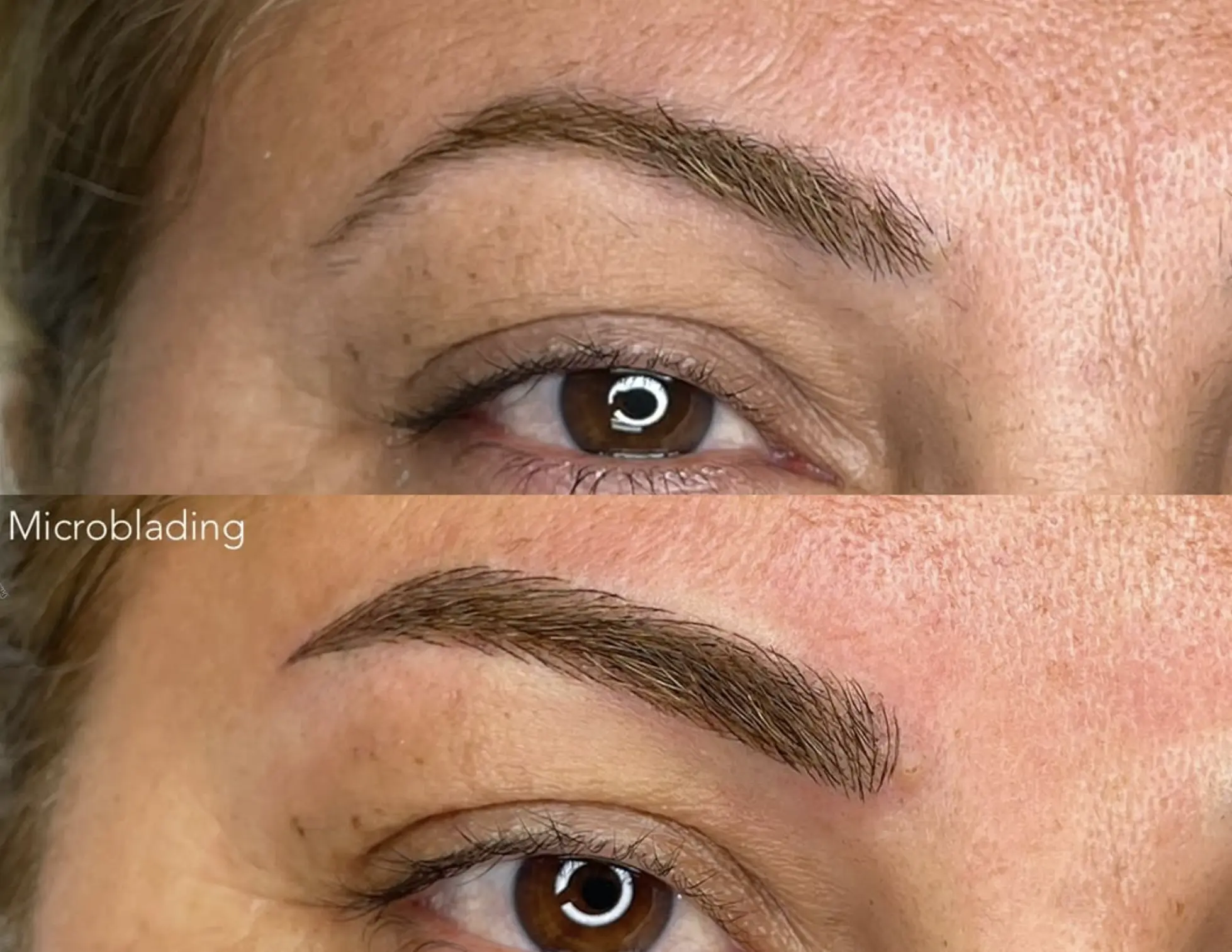 microblading and botox timing